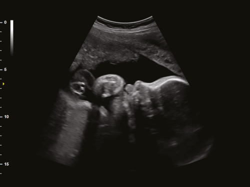 Face do feto às 29 semanas no modo 2D